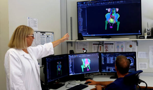 Suksess med kunstig intelligens i strålebehandlinga