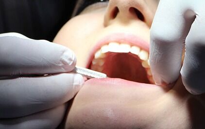 Reduserer det offentlege tannhelsetilbodet